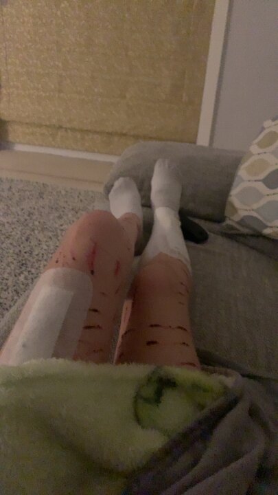 Thigh cut deals