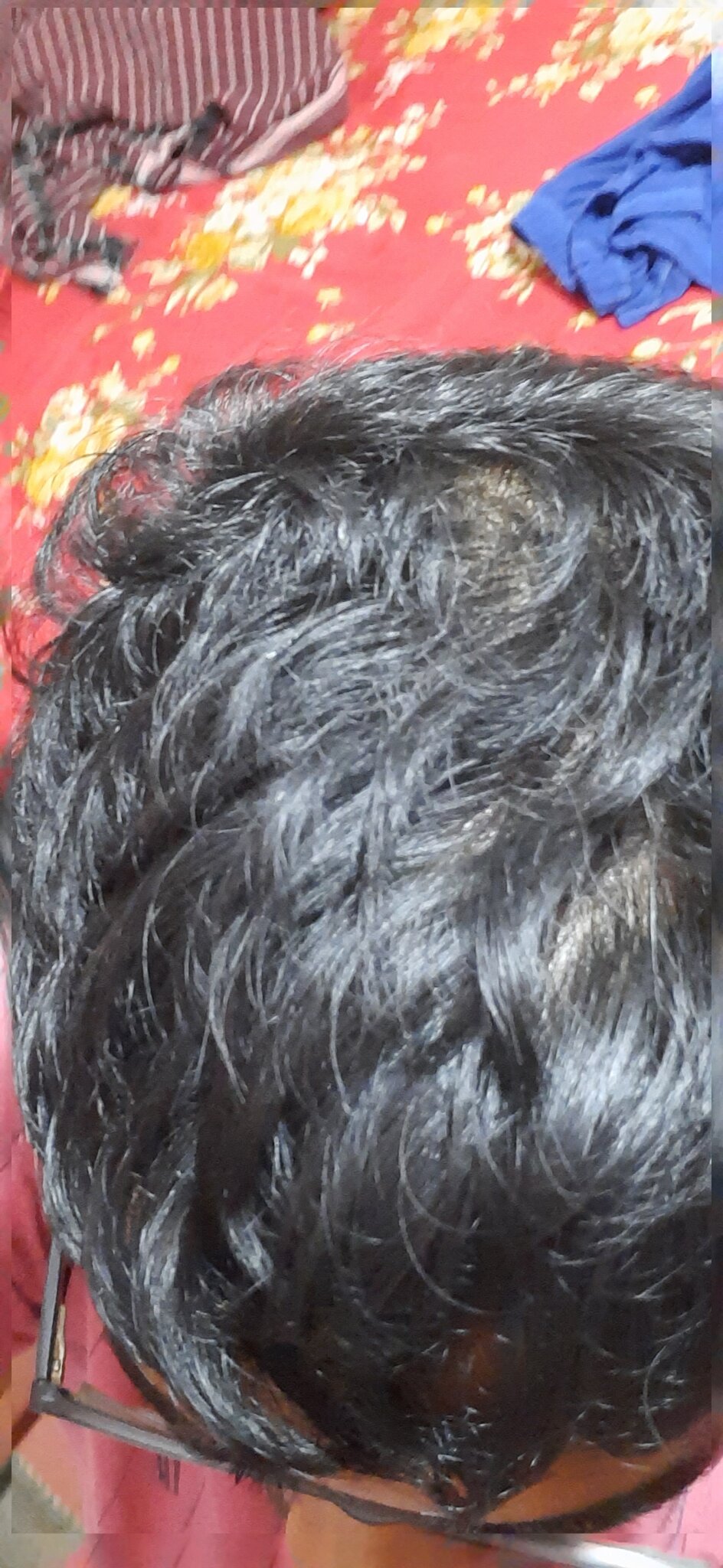 Is my hair fine or is it thinning? Why can I see little bit of scalp